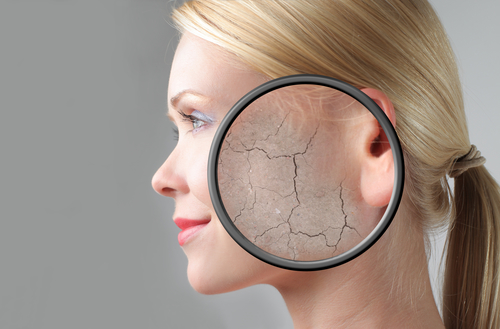 magnifying glass over woman's skin showing dry skin