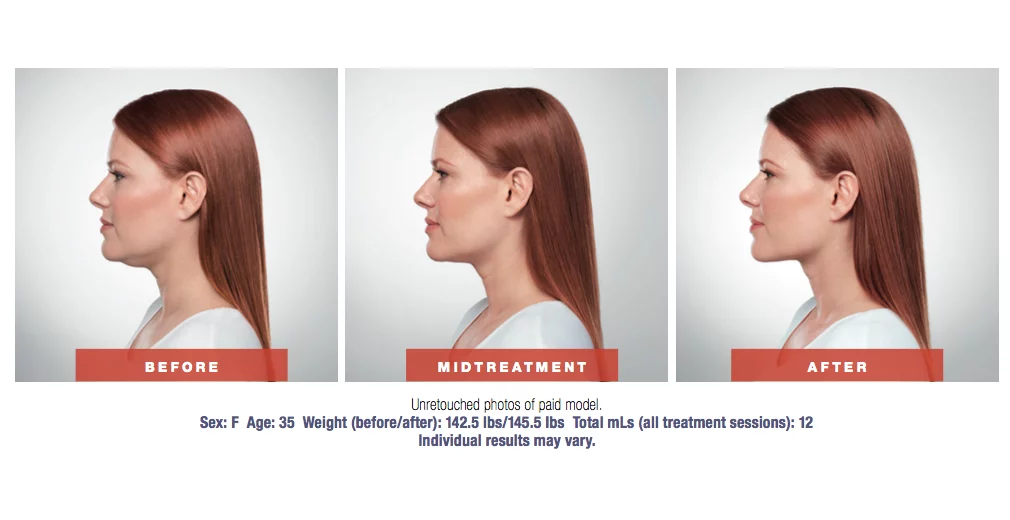Radiance Wheaton Laser & Medspa Image