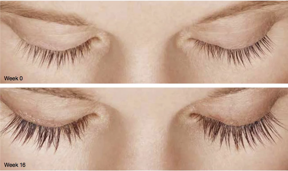 Radiance Wheaton Laser & Medspa Blog