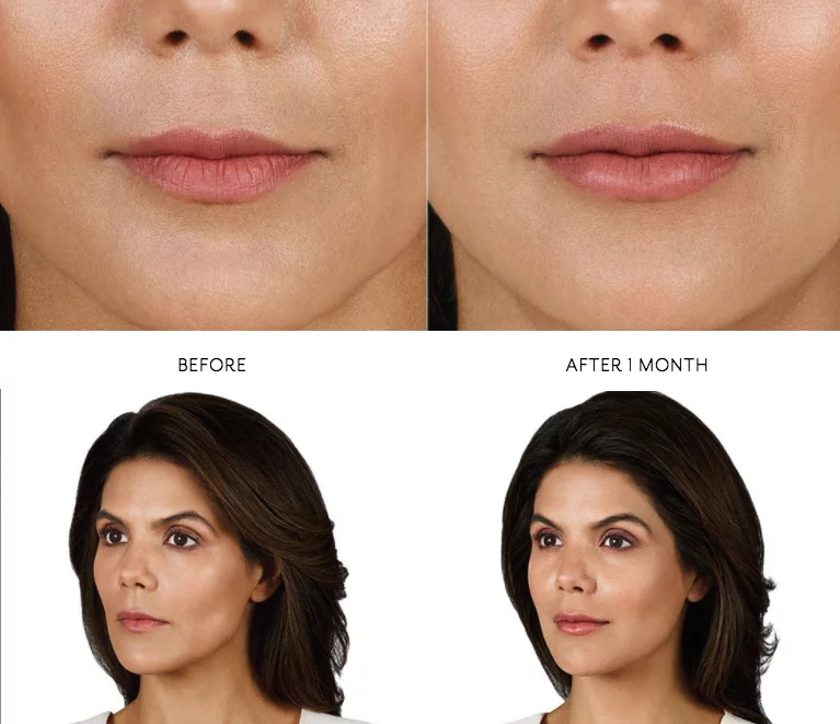 Radiance Wheaton Laser & Medspa Blog