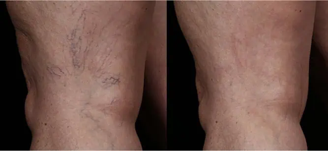 Radiance Wheaton Laser & Medspa Blog