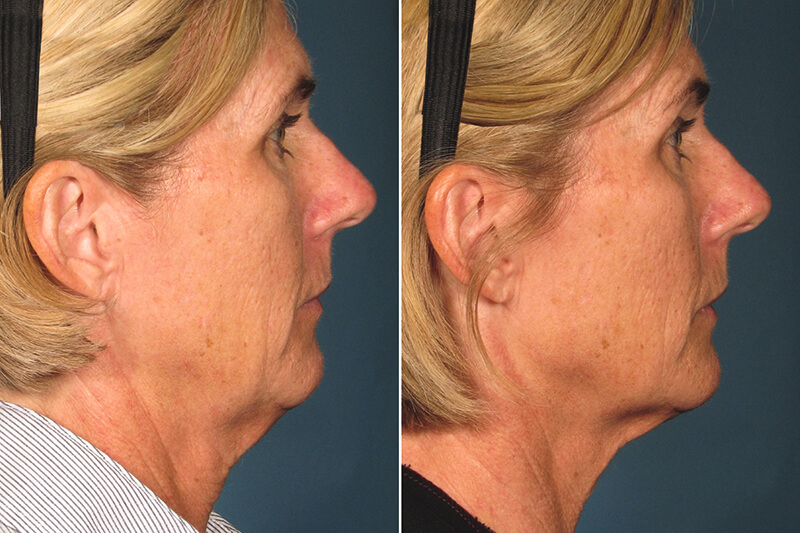 Our Specials - Radiance Skincare & Laser Medspa - Wheaton, IL