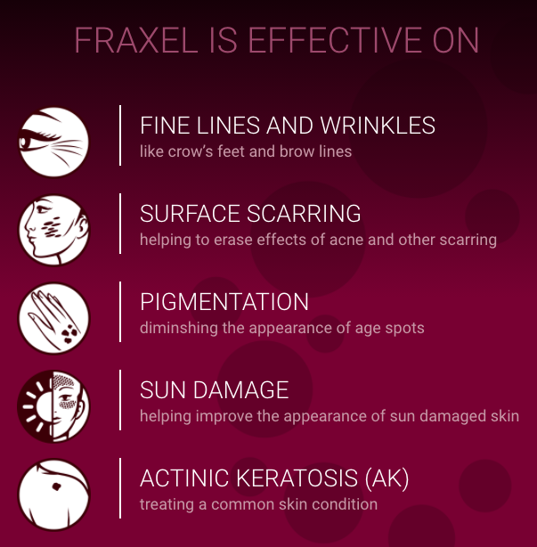 fraxel conditions graphic