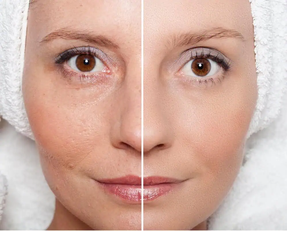 Radiance Wheaton Laser & Medspa Blog