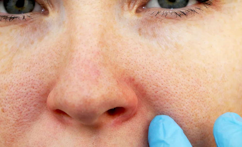 Radiance Wheaton Laser & Medspa Blog