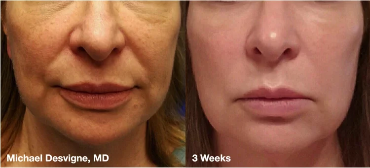 Radiance Wheaton Laser & Medspa Blog