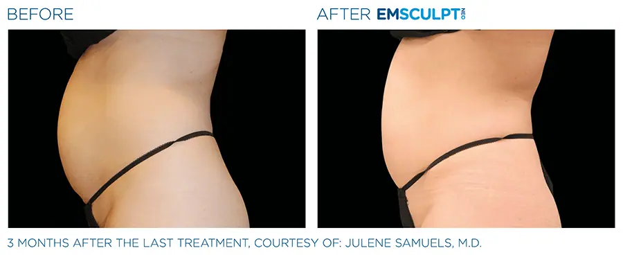 Radiance Wheaton Laser & Medspa Blog
