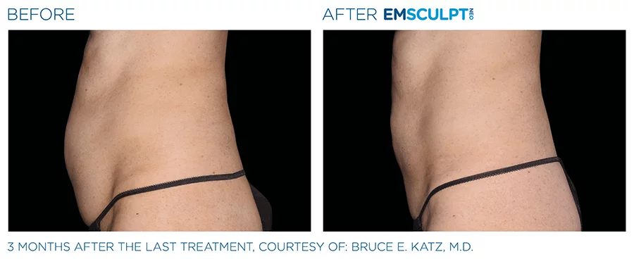 Radiance Wheaton Laser & Medspa Blog