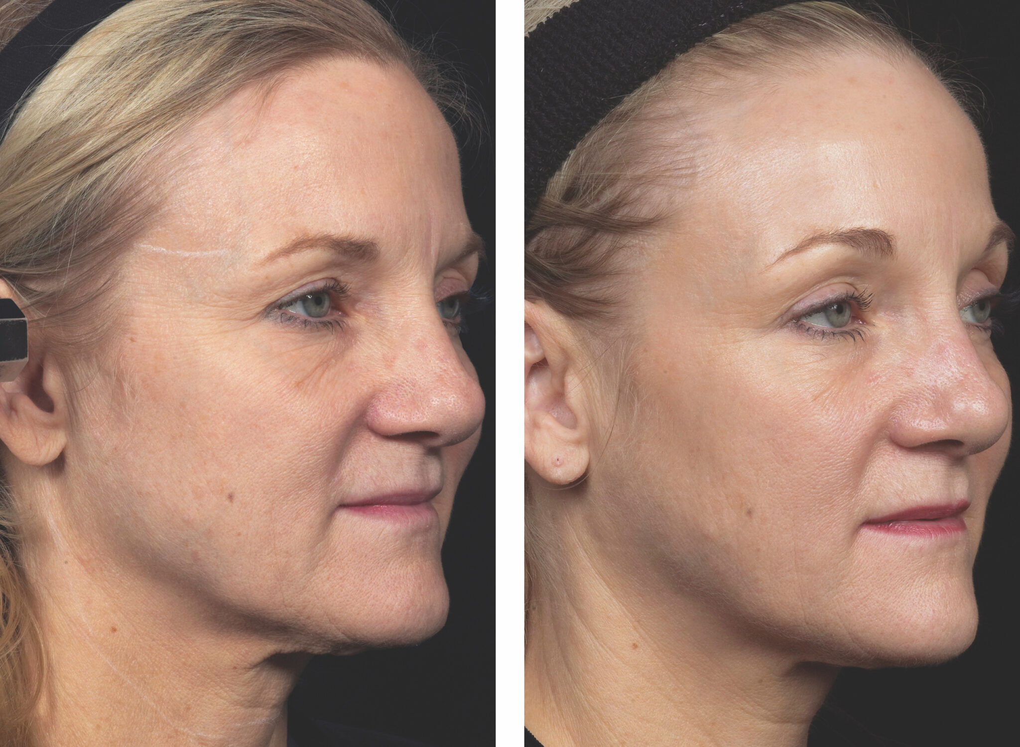 Our Specials - Radiance Skincare & Laser Medspa - Wheaton, IL