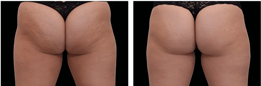 Radiance Wheaton Laser & Medspa Blog