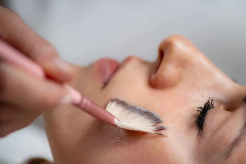 Radiance Wheaton Laser & Medspa Chemical Peel