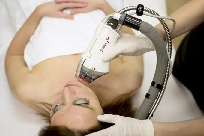 Radiance Wheaton Laser & Medspa Fraxel