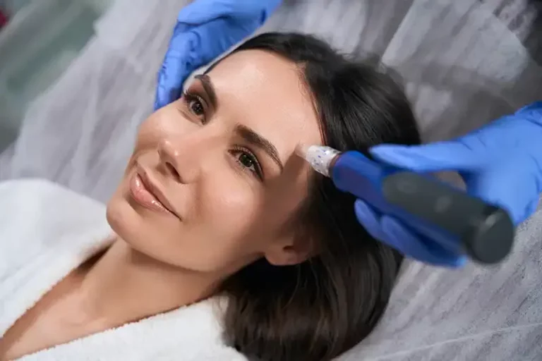 Radiance Wheaton Laser & Medspa Microneedling